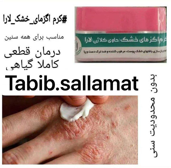 کرم اگزما