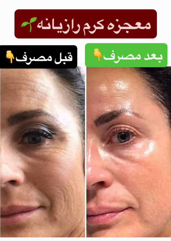 کرم رازیانه