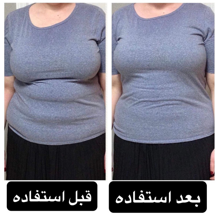 کوچک کننده سینه
