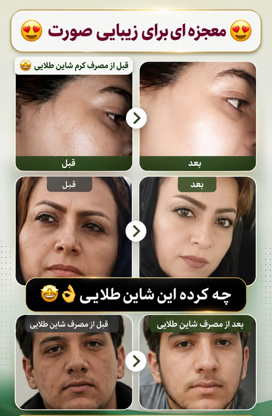 پک گیاهی ضد لک و جوش شاین طلایی