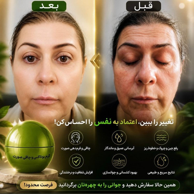 کرم بوتاکس